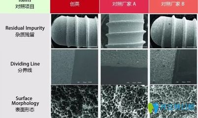 國產種植牙系統新星 創英種植牙系統的優勢與研究所技術實力解析